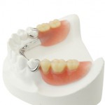 Removable Partial Denture Prosthesis