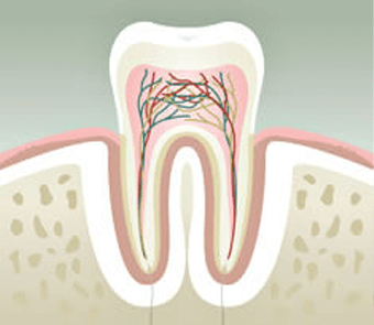 Root Canal Treatment in Montreal