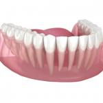 Periodontal Treatment in Montreal